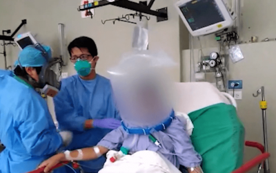 Paciente con Covid-19 mejora y evita intubación con Oxigenador No Invasivo de la UNI